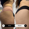 Lóc’up – Complexo Firmador de Seios e Nádegas 100g